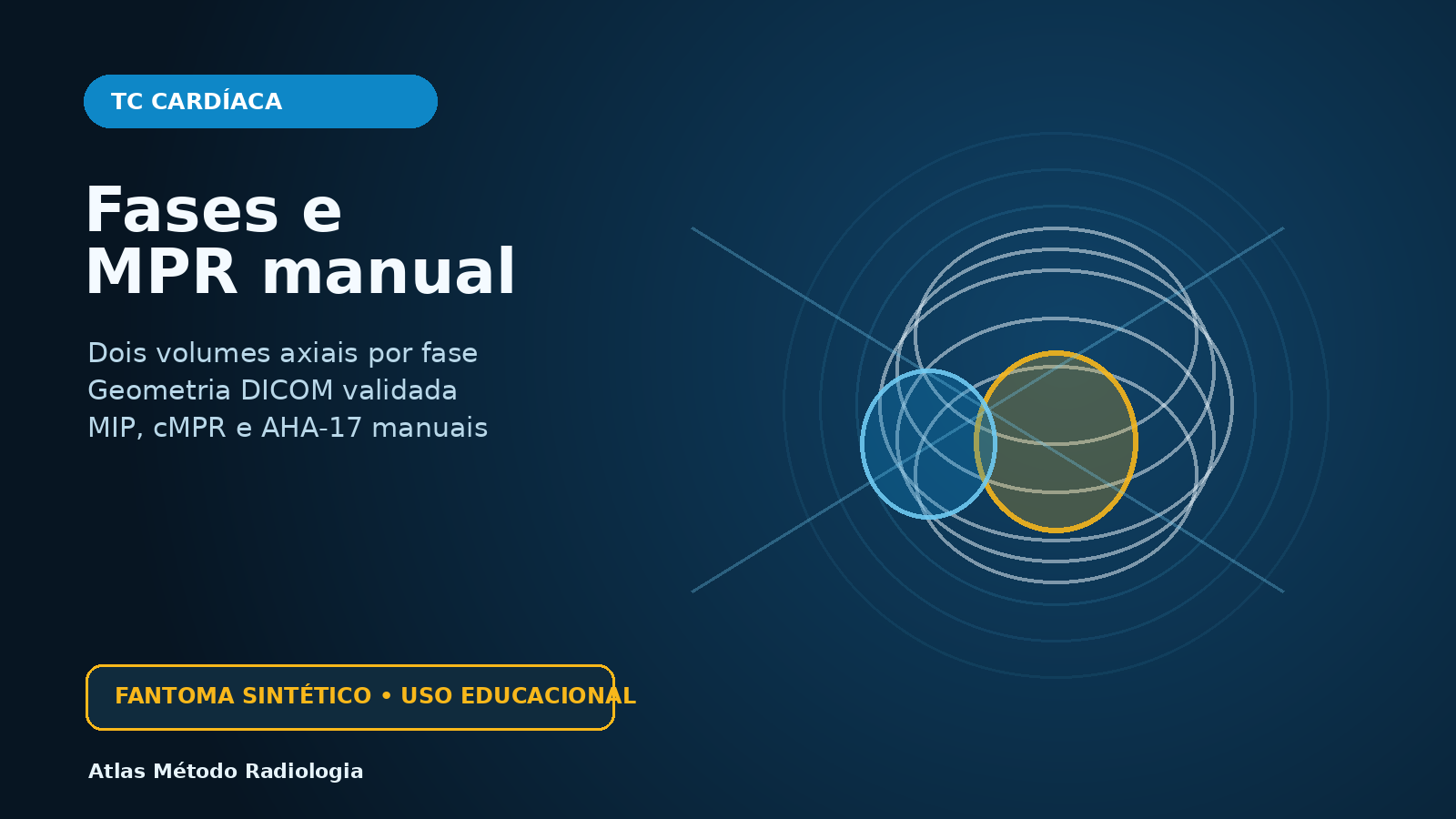 Capa educacional de TC cardíaca sintética: fases e MPR manual