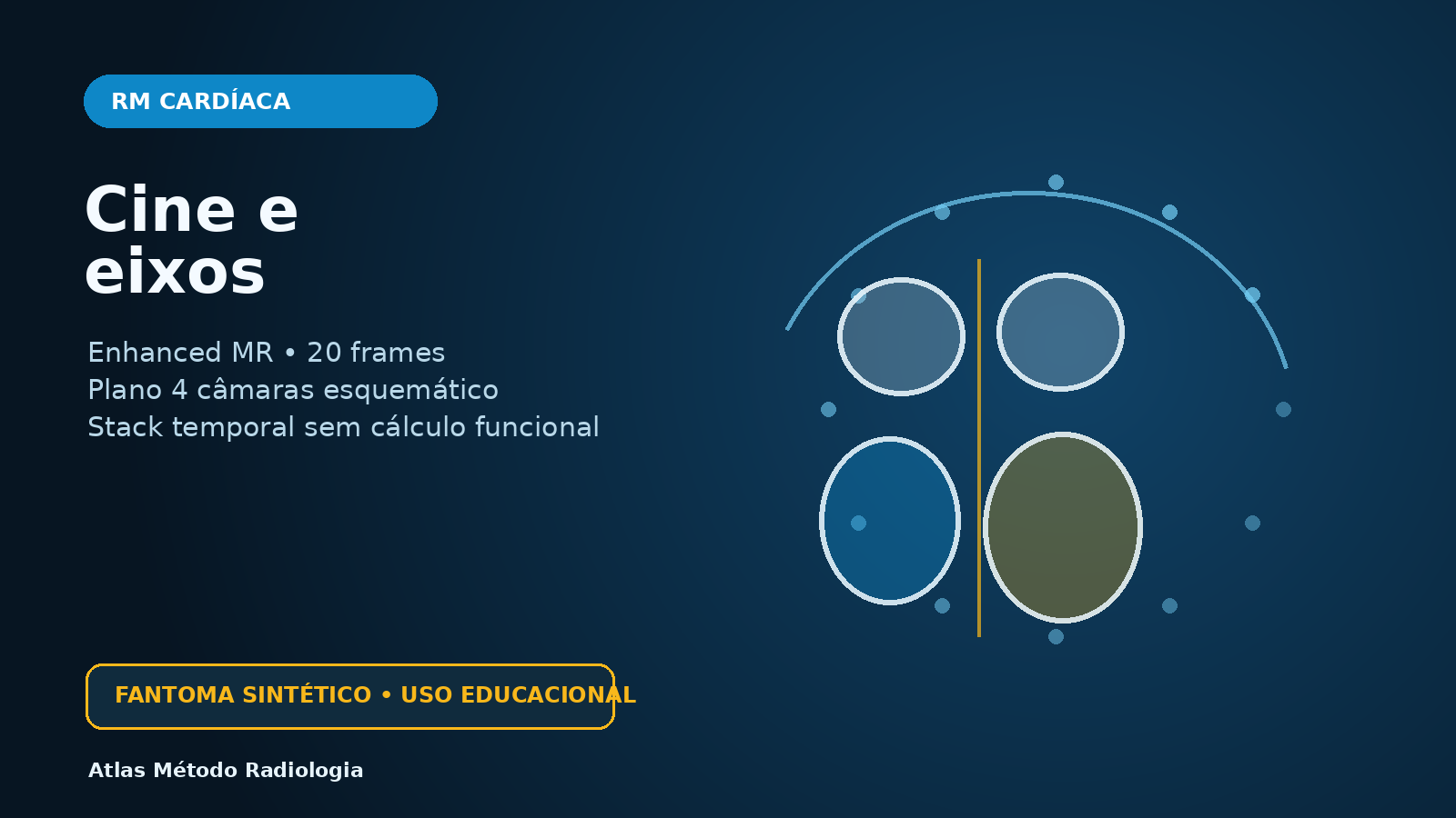 Capa educacional de RM cardíaca sintética: cine e eixos