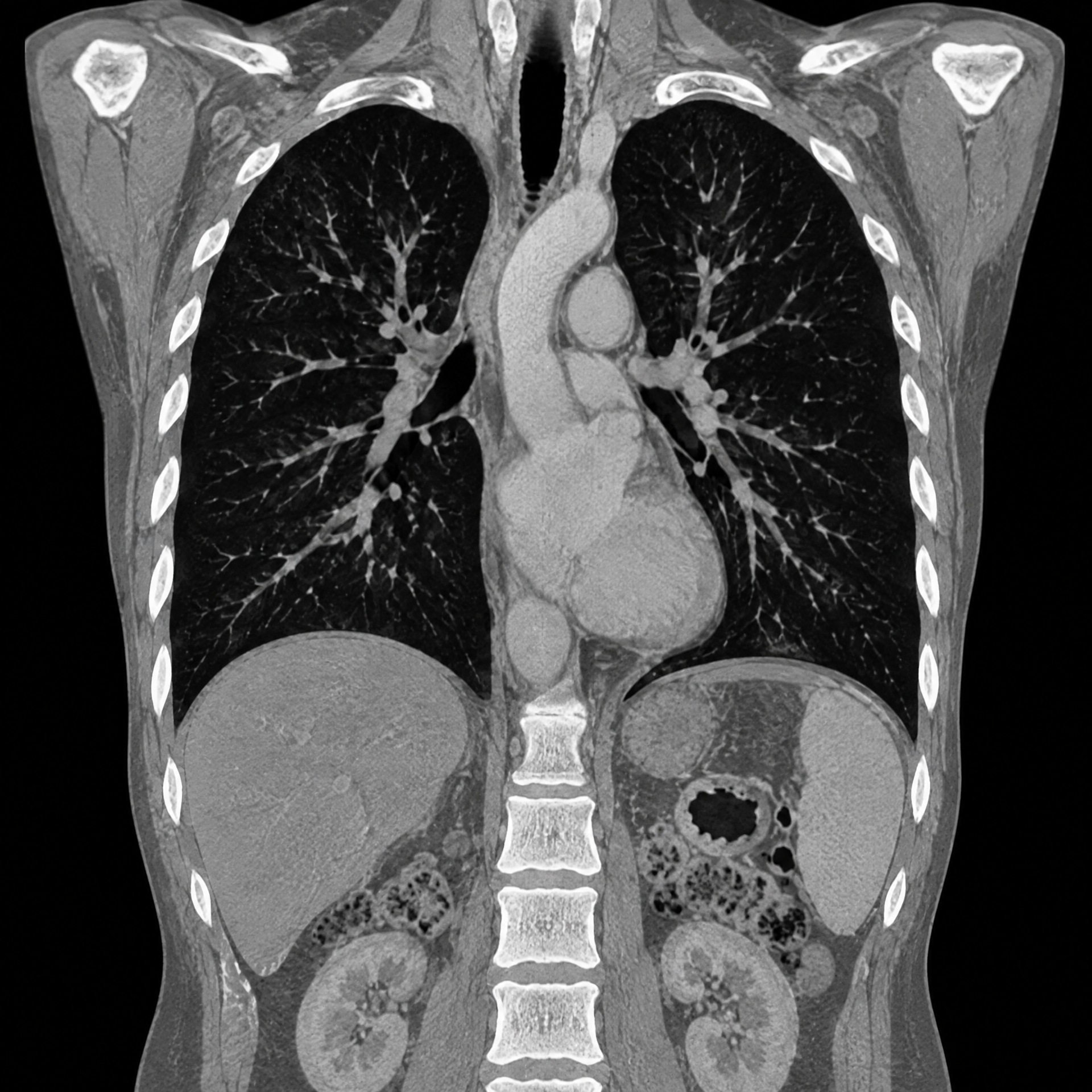 Capa educacional de Anatomia do tórax em TC